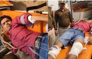 मोतिहारी में पुलिस व अपराध के बीच मुठभेड़, बैंककर्मी की हत्या मामले में वांछित समीर सिंह के दोनों पैरों में लगी गोली