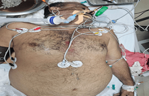 ब्रेकिंग न्यूजः धोखे के जहर से हुई रिटायर्ड सैनिक की मौत, तुरकौलिया के इस मुखिया पर प्राथमिकी दर्ज