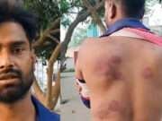 मोतिहारी में दबंगों ने युवक को बेरहमी से पीटा, पुलिस से लगाई न्याय की गुहार