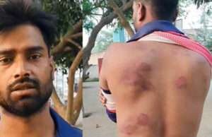 मोतिहारी में दबंगों ने युवक को बेरहमी से पीटा, पुलिस से लगाई न्याय की गुहार
