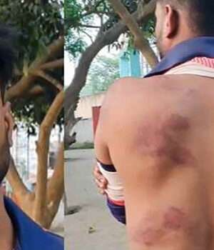 मोतिहारी में दबंगों ने युवक को बेरहमी से पीटा, पुलिस से लगाई न्याय की गुहार